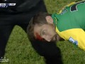 Выбитые зубы и реки крови: Страшное видео с матча Норвич - Челси