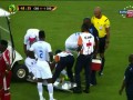 Кубок Африки: Машина медпомощи наехала на травмированного футболиста