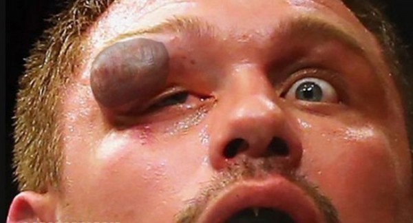 �������� ����� ��������