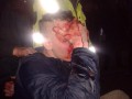 Пьяные российские фанаты напали на протестующих в Молдове